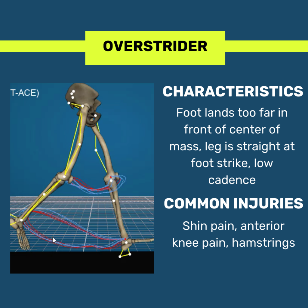 Orthotics ATLANTA SPORT AND SPINE PHYSICAL THERAPY