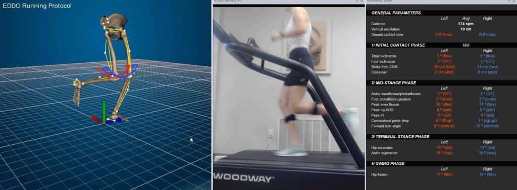 Running Analysis – ATLANTA SPORT AND SPINE PHYSICAL THERAPY